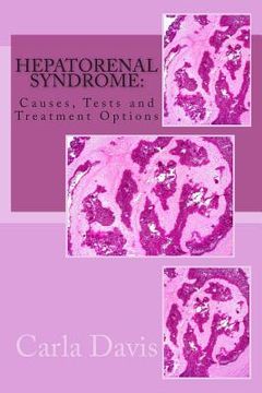portada Hepatorenal Syndrome: Causes, Tests and Treatment Options (in English)