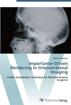 portada Importance-Driven Rendering in Interventional Imaging: A New Visualization Technique for Minimal-Invasive Surgeries