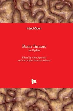 portada Brain Tumors: An Update (en Inglés)