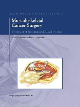 portada Musculoskeletal Cancer Surgery: Treatment of Sarcomas and Allied Diseases (in English)
