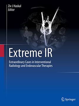portada Extreme IR: Extraordinary Cases in Interventional Radiology and Endovascular Therapies (in English)