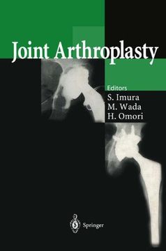 portada joint arthroplasty (en Inglés)