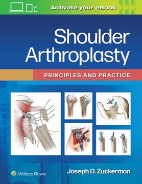 portada Shoulder Arthroplasty: Principles and Practice (en Inglés)