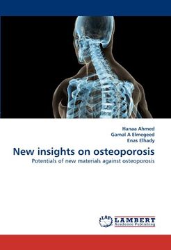 portada New insights on osteoporosis