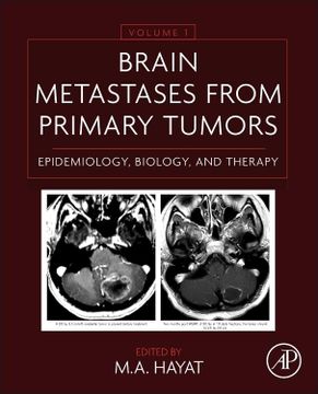 portada Brain Metastases From Primary Tumors Volume 1: Epidemiology, Biology, and Therapy (en Inglés)