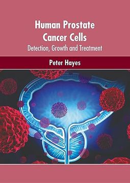 portada Human Prostate Cancer Cells: Detection, Growth and Treatment (en Inglés)
