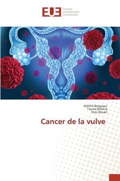 portada Cancer de la vulve (en Francés)