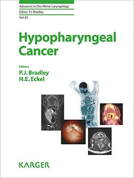 portada Hypopharyngeal Cancer (en Inglés)