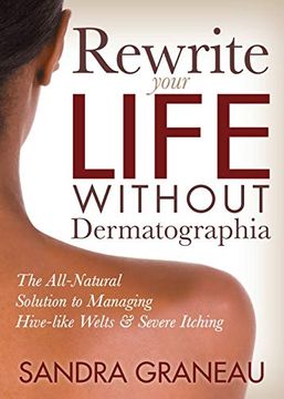 portada Rewrite Your Life Without Dermatographia: The All-Natural Solution to Managing Hive-Like Welts and Severe Itching (in English)