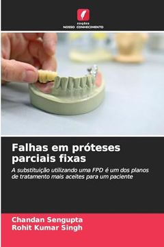 portada Falhas em Próteses Parciais Fixas (in Portuguese)