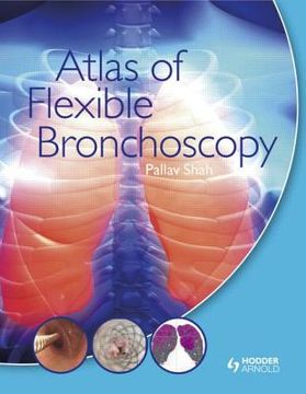 portada atlas of flexible bronchoscopy