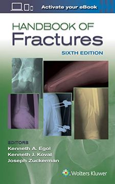 portada Handbook of Fractures 