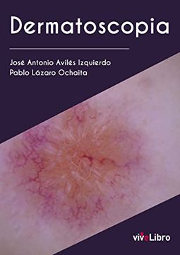 portada Dermatoscopia (in Spanish)