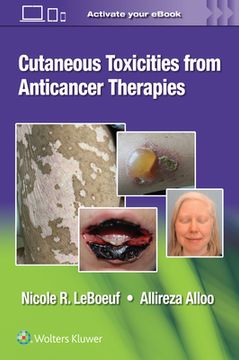 portada Cutaneous Toxicities from Anticancer Therapies (en Inglés)