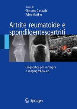portada artrite reumatoide e spondiloentesoartriti (in Italian)