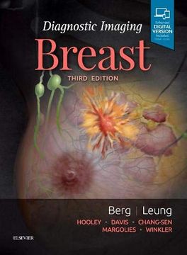 portada Diagnostic Imaging: Breast (in English)