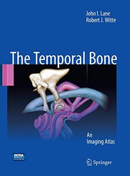 portada Temporal Bone: An Imaging Atlas (in English)