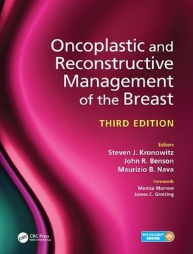 Oncoplastic and Reconstructive Management of the Breast, Third Edition (en Inglés)