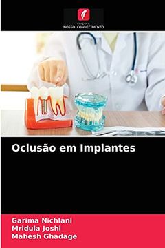 portada Oclusão em Implantes (en Portugués)