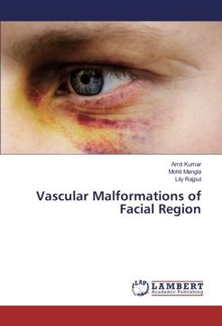 portada Vascular Malformations of Facial Region