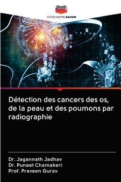 portada Détection des cancers des os, de la peau et des poumons par radiographie (en Francés)