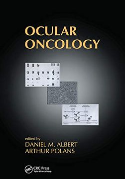 portada Ocular Oncology (en Inglés)
