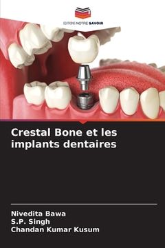 portada Crestal Bone et les implants dentaires (in French)