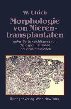 portada Morphologie Von Nierentransplantaten: Unter Berücksichtigung Von Ciclosporineffekten Und Virusinfektionen (en Alemán)