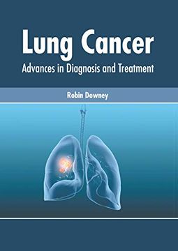 portada Lung Cancer: Advances in Diagnosis and Treatment (en Inglés)