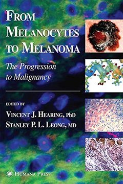 portada From Melanocytes to Melanoma: The Progression to Malignancy
