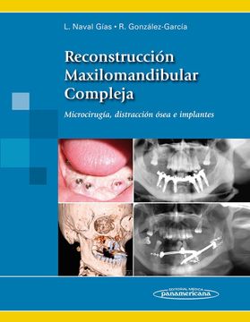 portada Reconstruccion Maxilomandibular Compleja. Microcirugia, Distraccion Osea e Implantes (in Spanish)