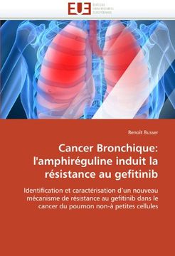 portada Cancer Bronchique: L'Amphireguline Induit La Resistance Au Gefitinib