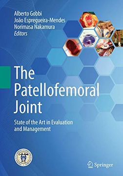 portada The Patellofemoral Joint: State of the art in Evaluation and Management (en Inglés)