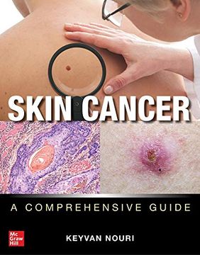 portada Skin Cancer: A Comprehensive Guide (in English)