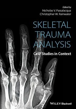 portada Skeletal Trauma Analysis (en Inglés)