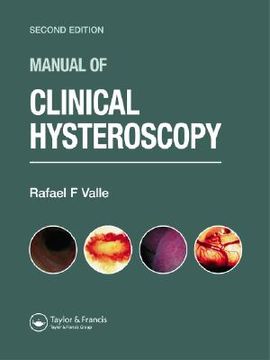 portada Manual of Clinical Hysteroscopy, Second Edition (in English)