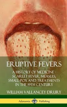 portada Eruptive Fevers: A History of Medicine - Scarlet Fever, Measles, Small-Pox and Treatments in the 19th Century (Hardcover)