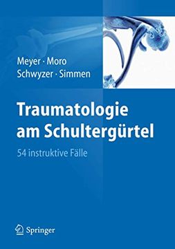 portada Traumatologie am Schultergürtel: 54 Instruktive Fälle (en Alemán)