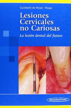 portada Cuniberti: Lesiones Cervicales no Cariosa: La Lesión Dental del Futuro (in Spanish)