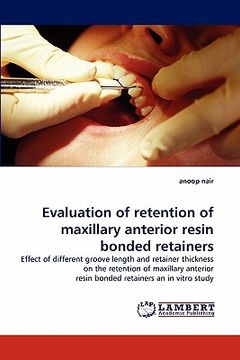 portada evaluation of retention of maxillary anterior resin bonded retainers (en Inglés)