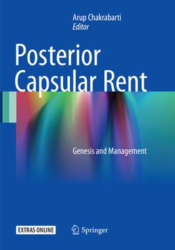 portada Posterior Capsular Rent: Genesis and Management (en Inglés)