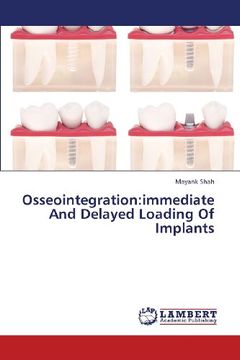 portada Osseointegration: Immediate and Delayed Loading of Implants