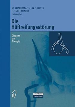 portada Die Hüftreifungsstörung: Diagnose und Therapie (en Alemán)
