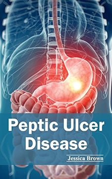 portada Peptic Ulcer Disease (en Inglés)