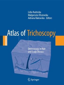 portada Atlas of Trichoscopy: Dermoscopy in Hair and Scalp Disease