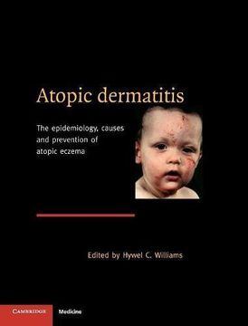 portada Atopic Dermatitis: The Epidemiology, Causes and Prevention of Atopic Eczema (en Inglés)