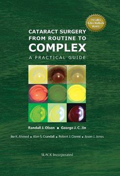 portada Cataract Surgery From Routine to Complex: A Practical Guide (in English)