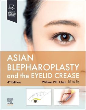 portada Asian Blepharoplasty and the Eyelid Crease (en Inglés)