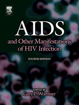 portada Aids and Other Manifestations of hiv Infection (in English)