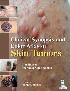 portada Clinical Synopsis and Color Atlas of Skin Tumors